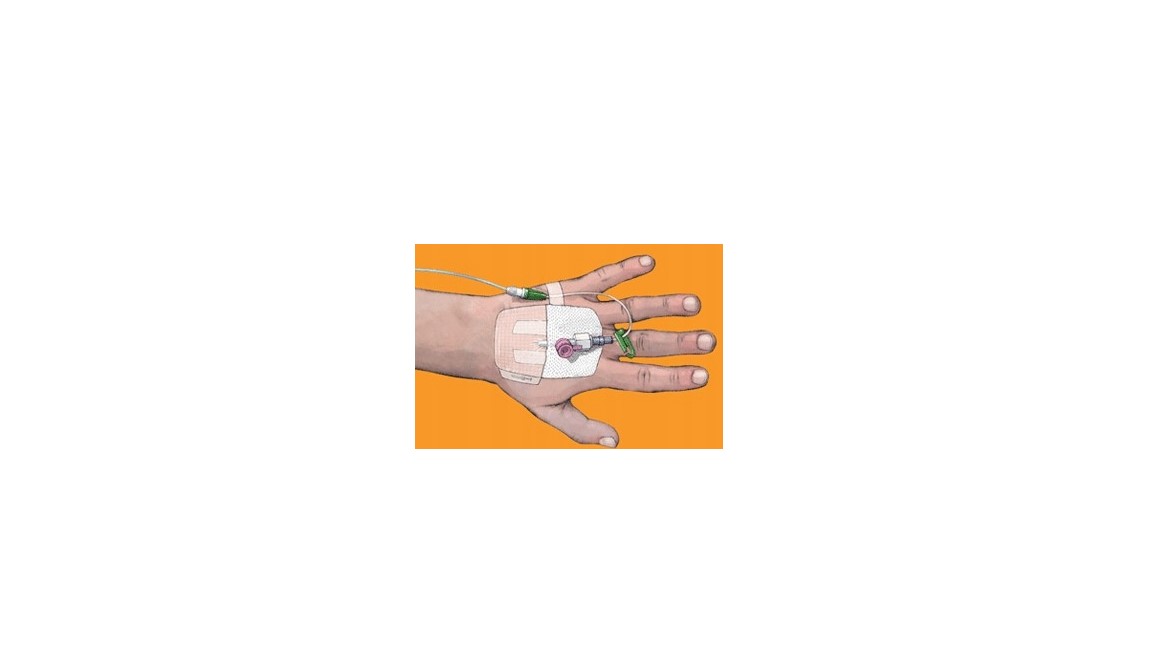 IV3000 1-HAND 10* 12cm 1 buc bandaj de fixare a inserției - Imagine 2